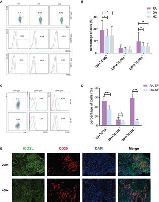 Inducible costimulator ligand (ICOSL) on CD19+ B cells is involved in immunopathological damage of rheumatoid arthritis (RA)